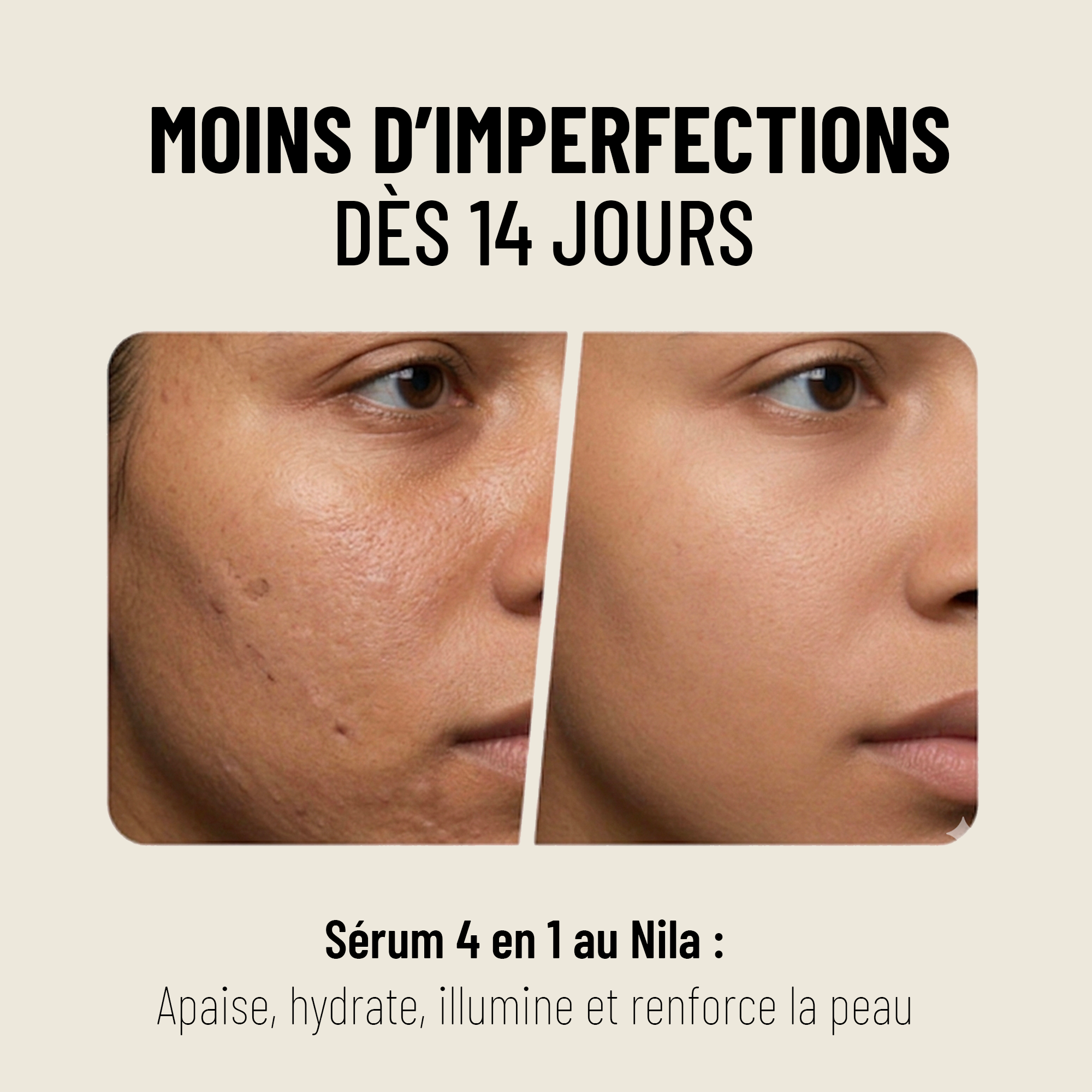 Sérum anti-imperfections au Nila