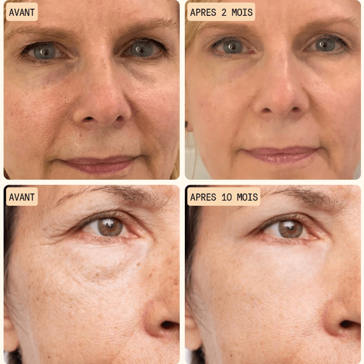 Soin contour des yeux